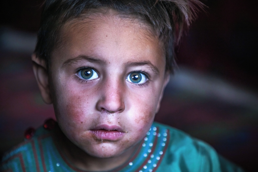 Afghanistan crisi conflitti fame e malnutrizione